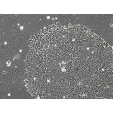 Human iPS Cell Line (Alzheimer's Disease)